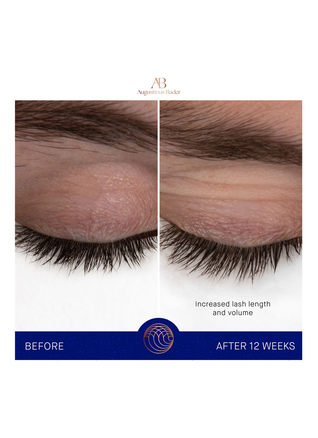 Augustinus Bader The Eyebrow & Lash Enhancing Serum - wenkbrauw- en wimper serum - detail 5 undefined