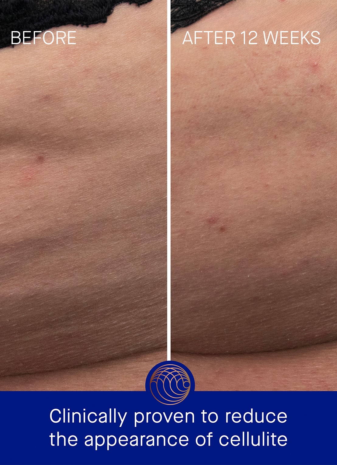 Augustinus Bader The Geranium Rose Body Cream - detail 2 undefined