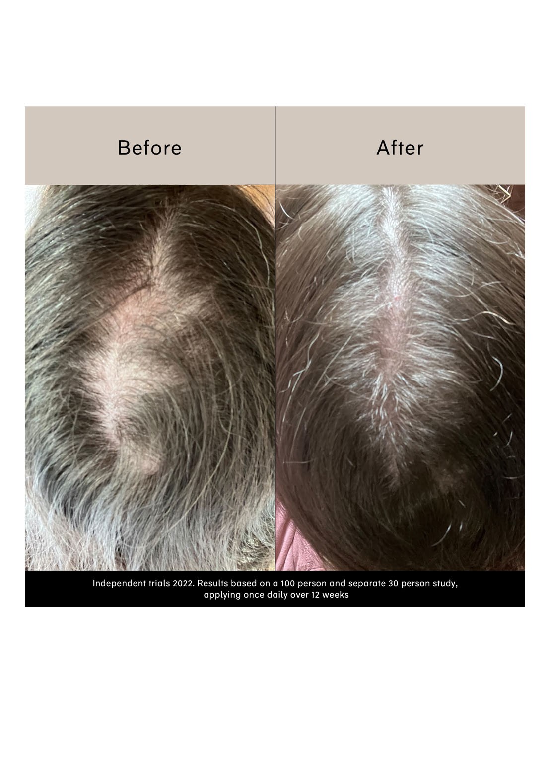 Chāmpo Pitta Growth Serum - haarserum - detail 3 undefined
