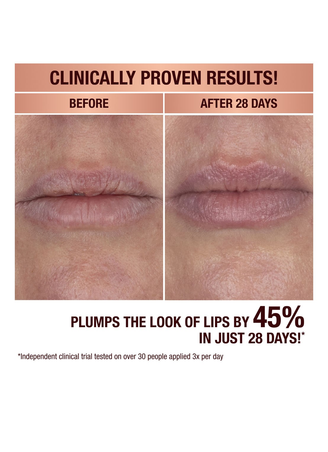 Charlotte Tilbury Life Changing Lip Mask - lipmasker - detail 2 pillow talk fresh glow