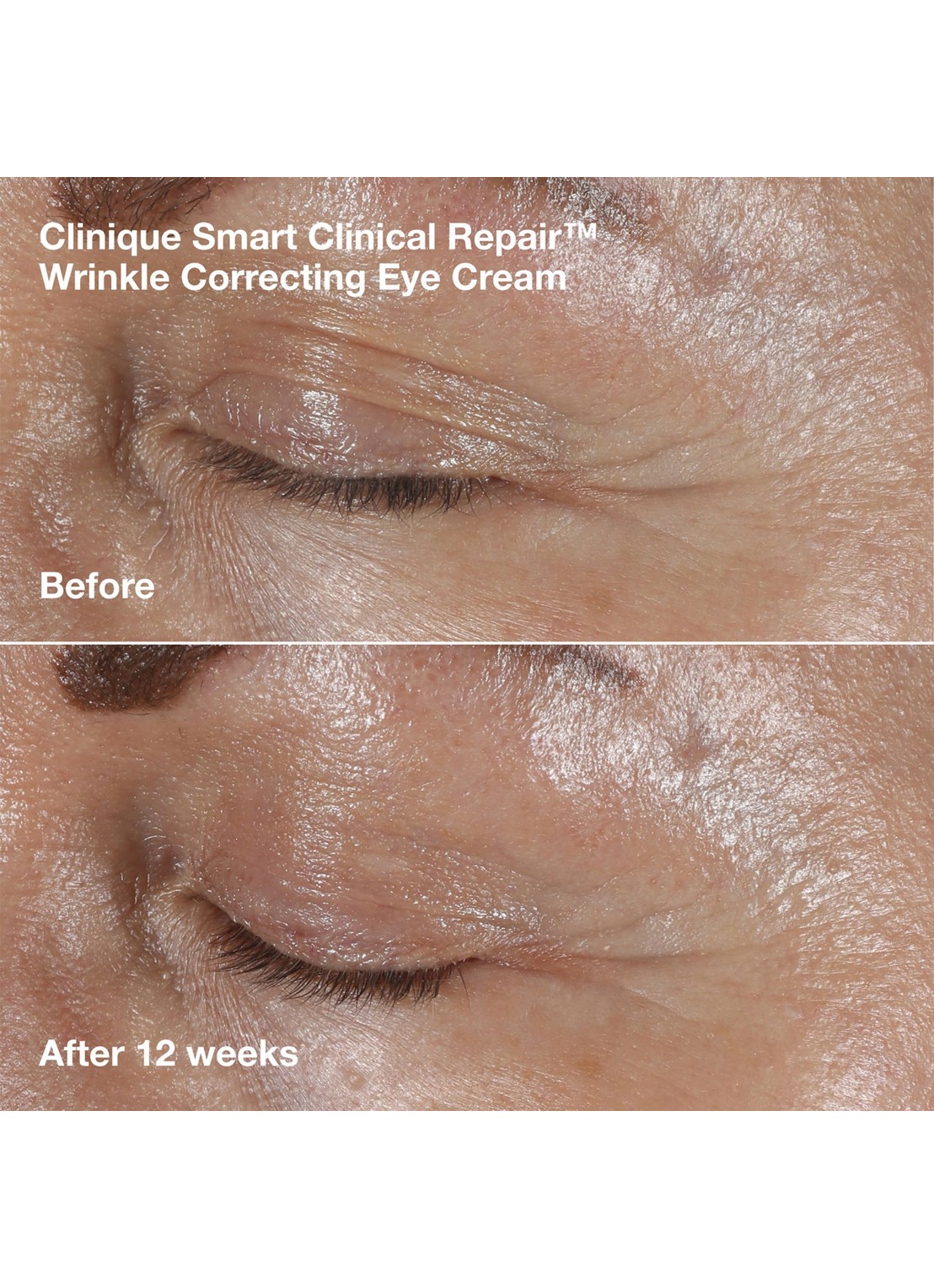 Clinique Clinique Smart Clinical Repair™ - anti-rimpel verzorgingsset - detail 3 undefined