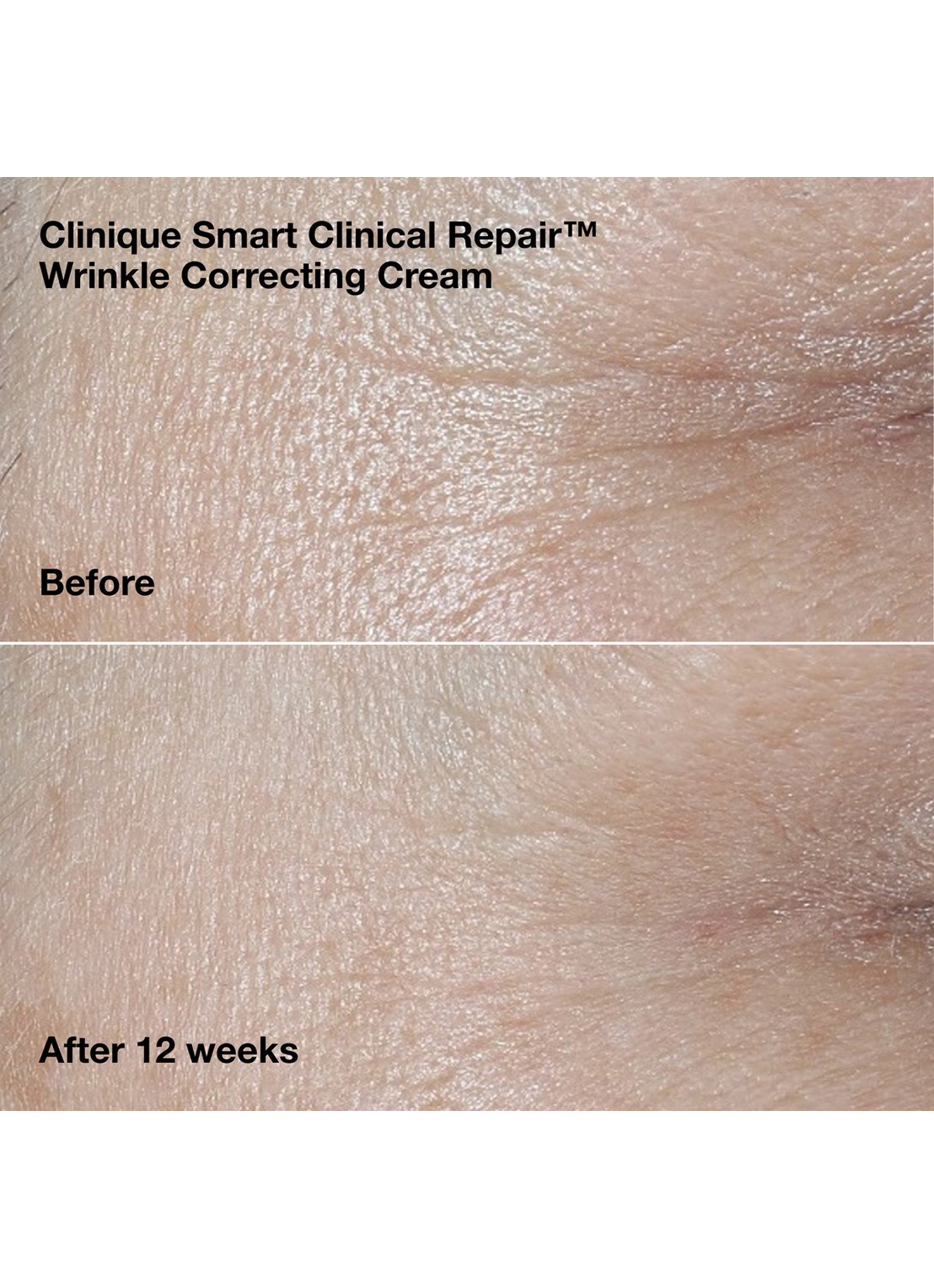 Clinique Clinique Smart Clinical Repair™ - anti-rimpel verzorgingsset - detail 4 undefined