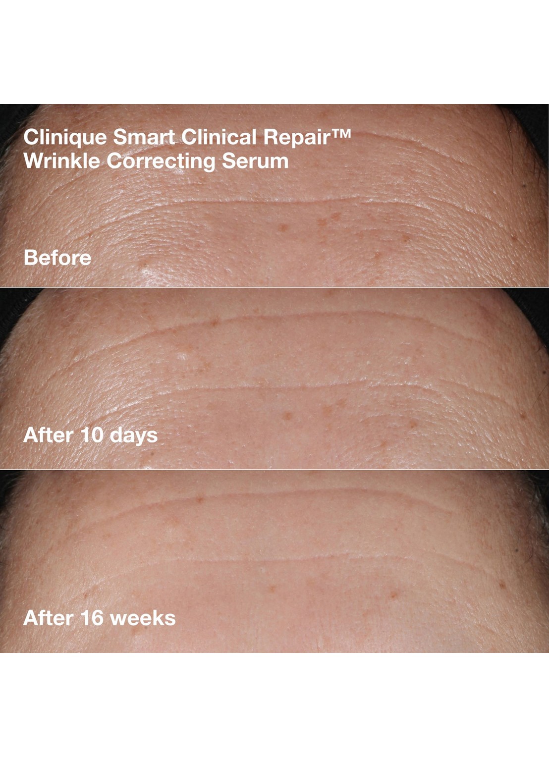 Clinique Clinique Smart Clinical Repair™ - anti-rimpel verzorgingsset - detail 5 undefined