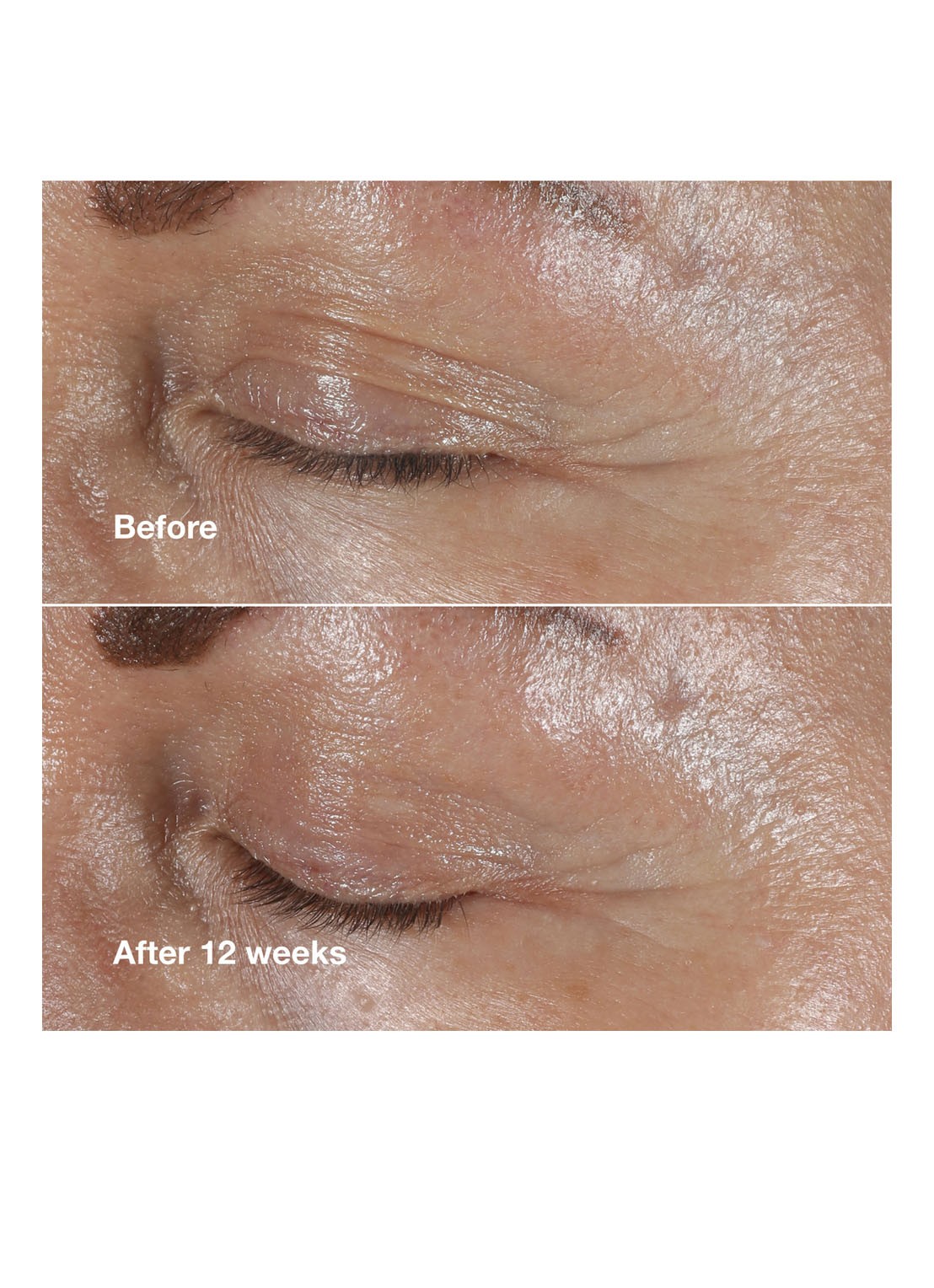 Clinique Clinique Smart Clinical Repair™ Wrinkle Correcting Eye Cream - oogcrème - detail 4 undefined
