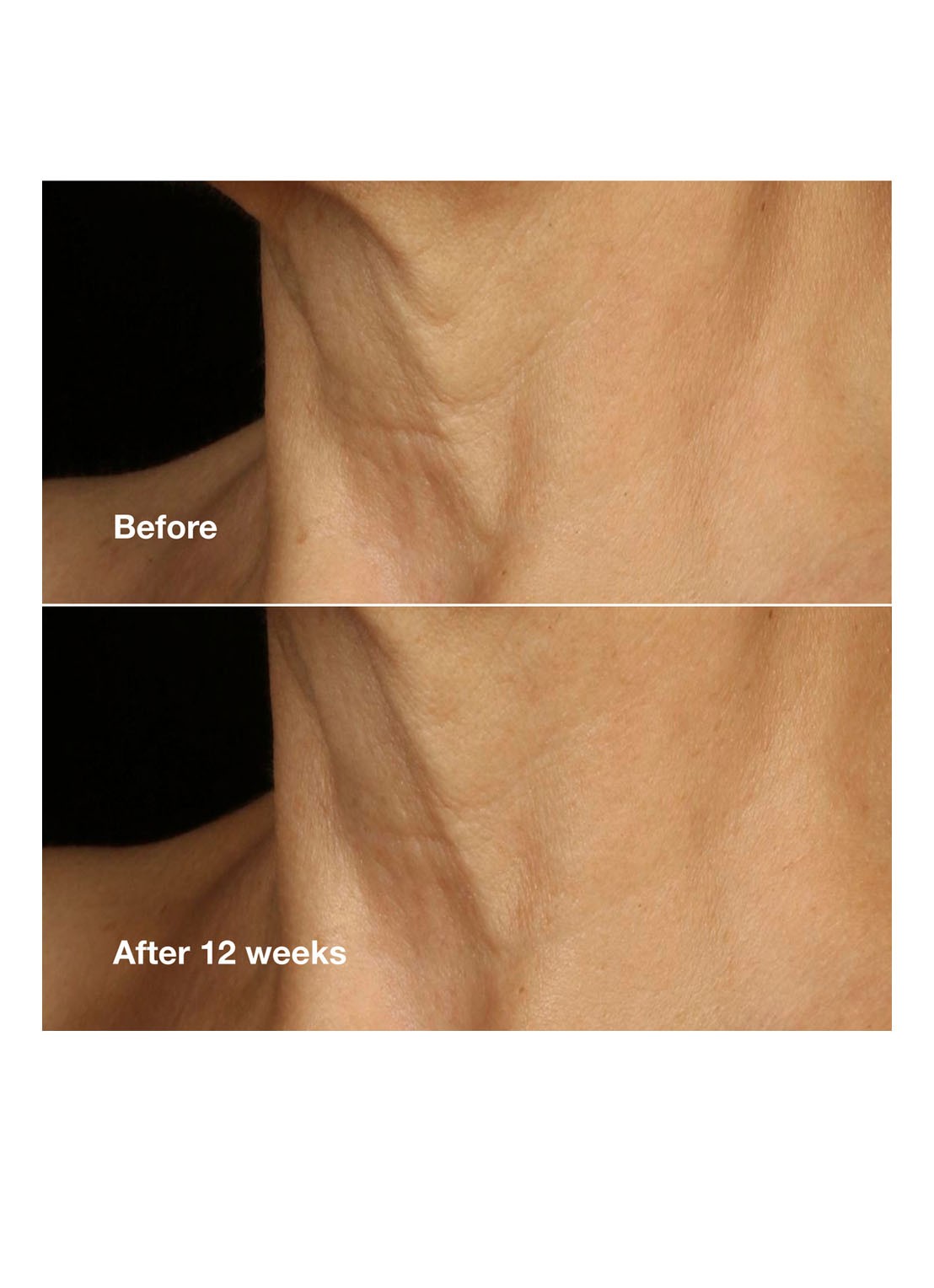 Clinique Clinique Smart Clinical Repair™ Lifting Face + Neck Cream - dagcrème - detail 3 undefined