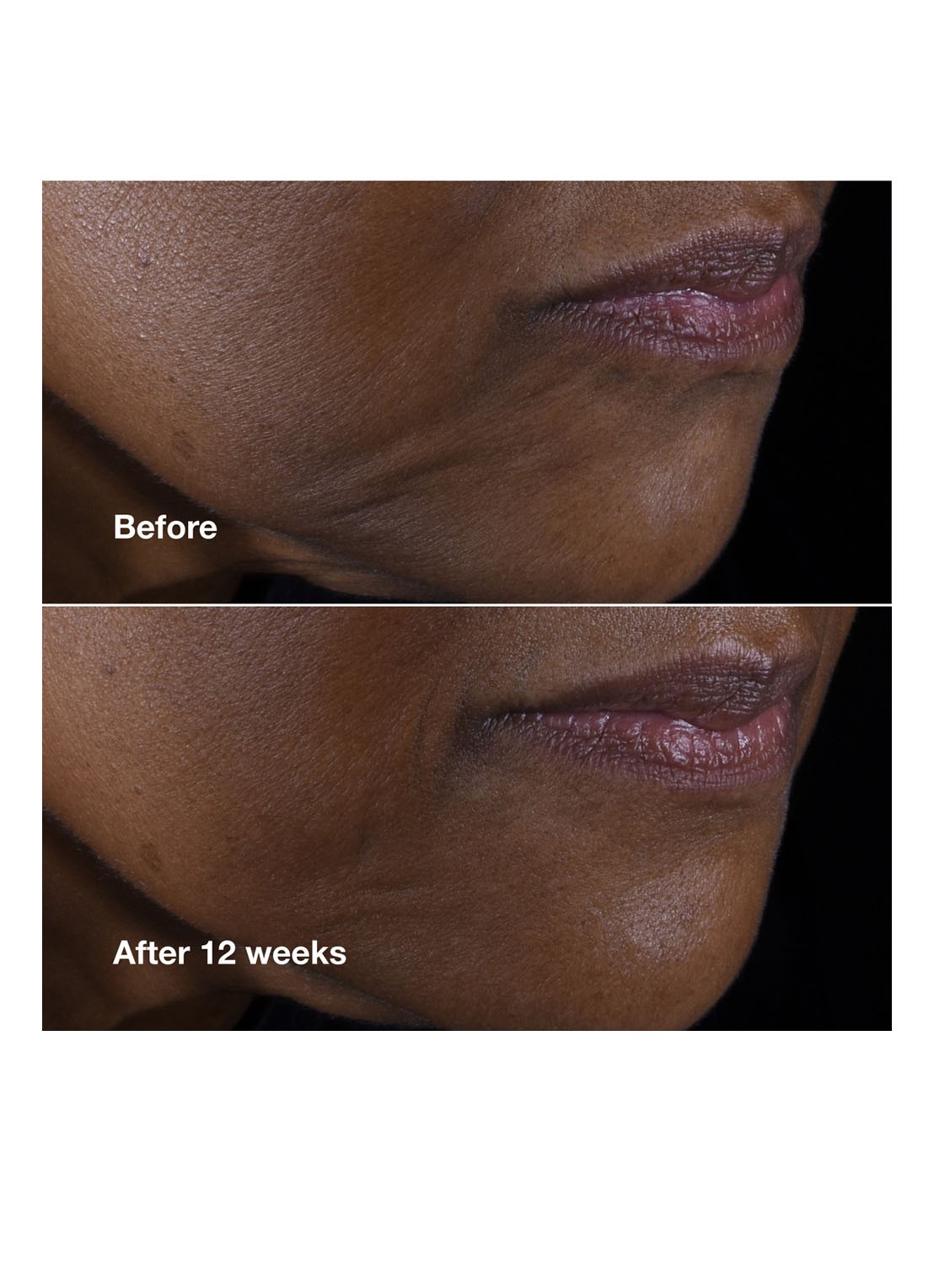 Clinique Clinique Smart Clinical Repair™ Lifting Face + Neck Cream - dagcrème - detail 4 undefined