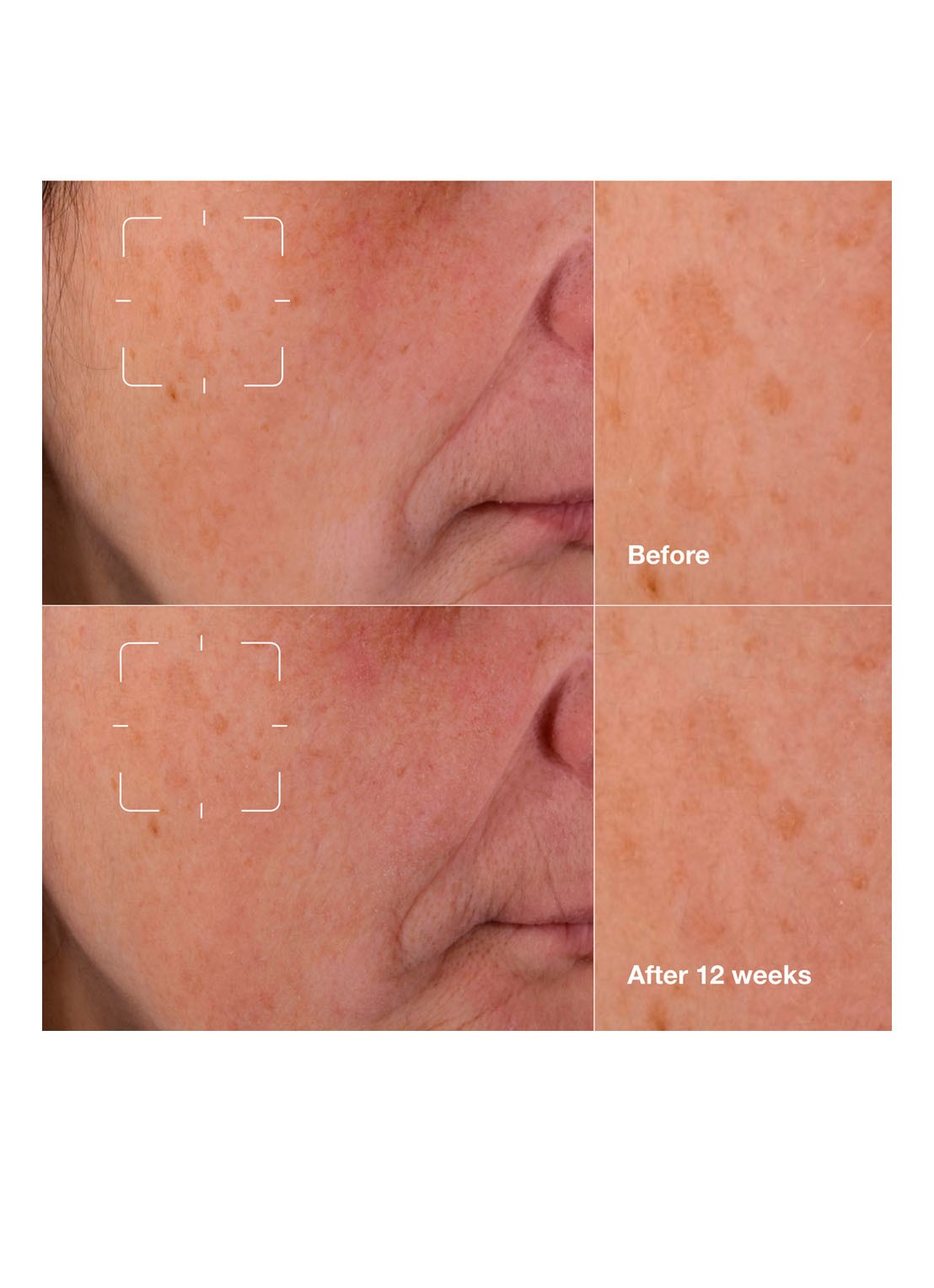 Clinique Even Better Clinical™ Dark Spot Clearing Serum - serum - detail 5 undefined