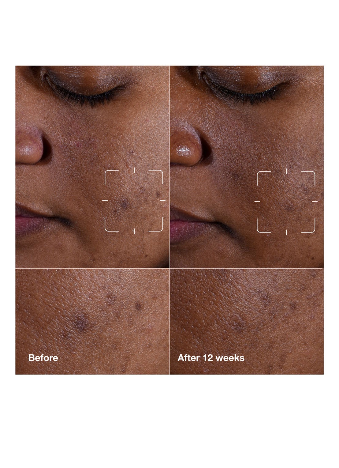 Clinique Even Better Clinical™ Dark Spot Clearing Serum - serum - detail 8 undefined