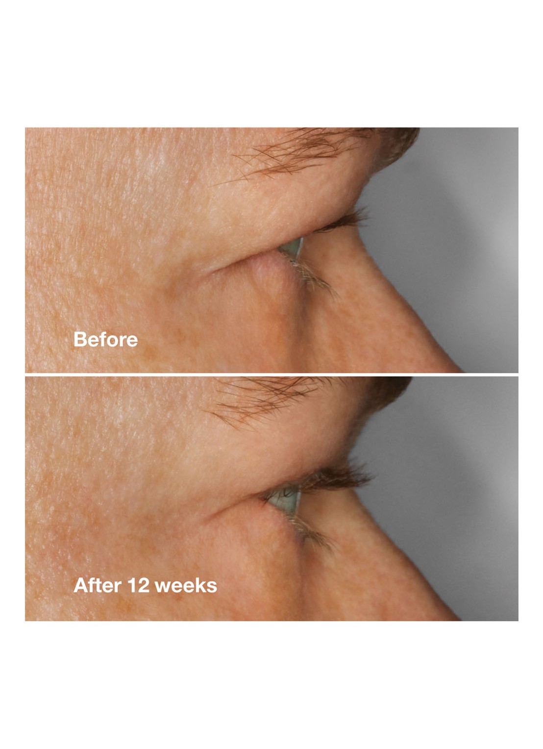 Clinique High Impact Lash Amplifying Serum - wimperserum - detail 2 undefined