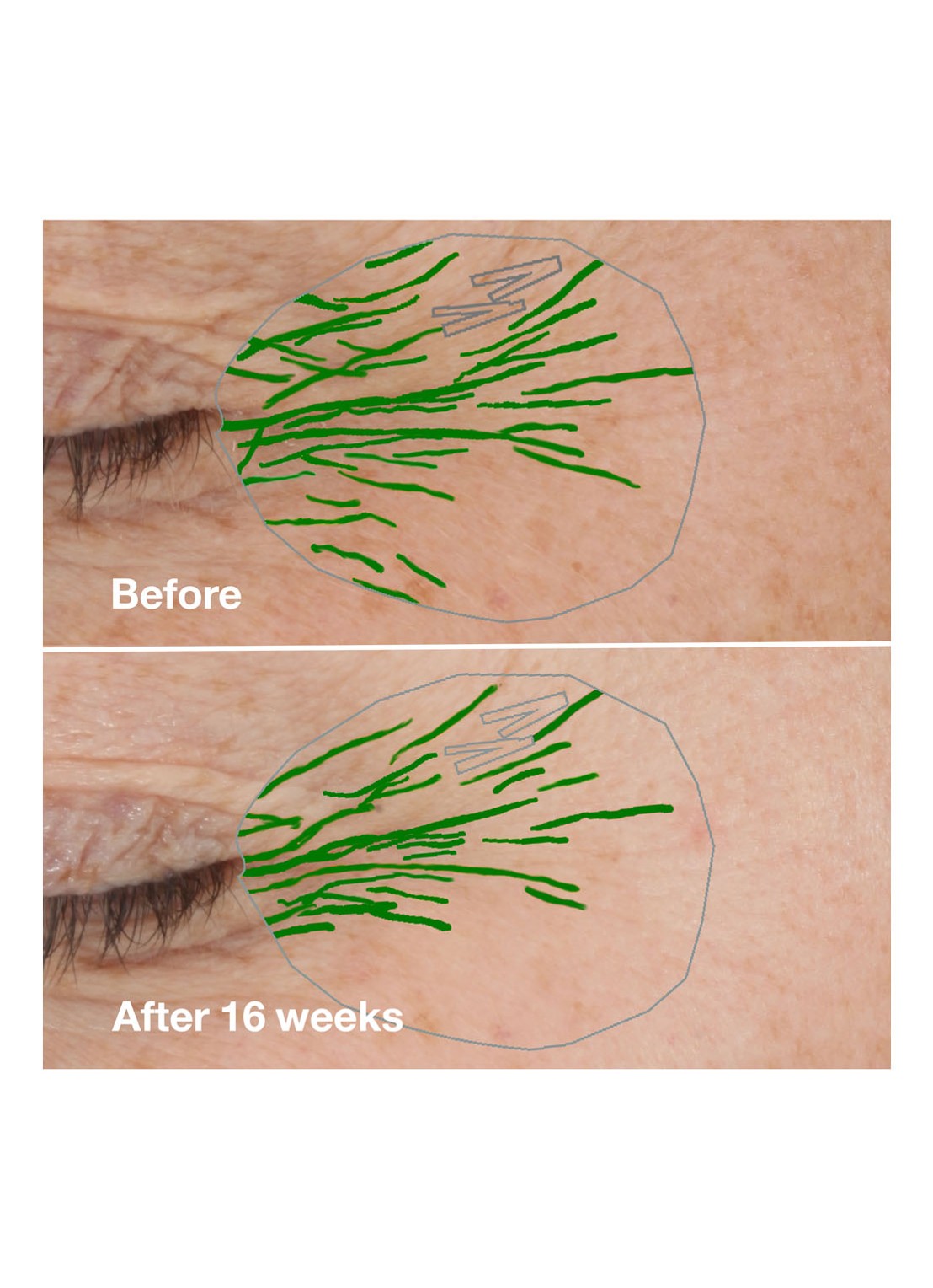 Clinique Smart Clinical Repair™ Wrinkle Correcting Rich Cream - dag- & nachtcrème - detail 3 undefined