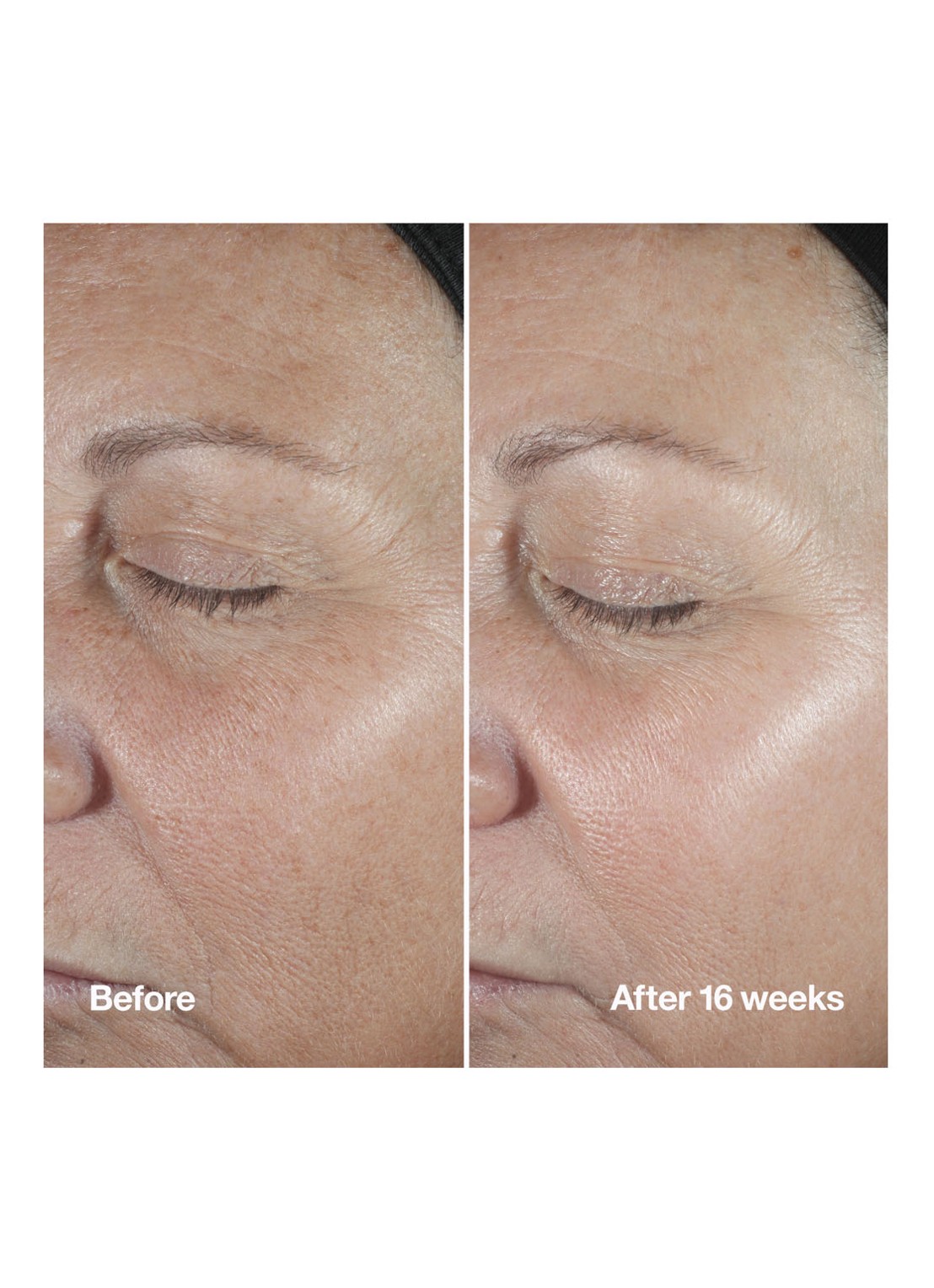 Clinique Smart Clinical Repair™ Wrinkle Correcting Serum - detail 2 undefined
