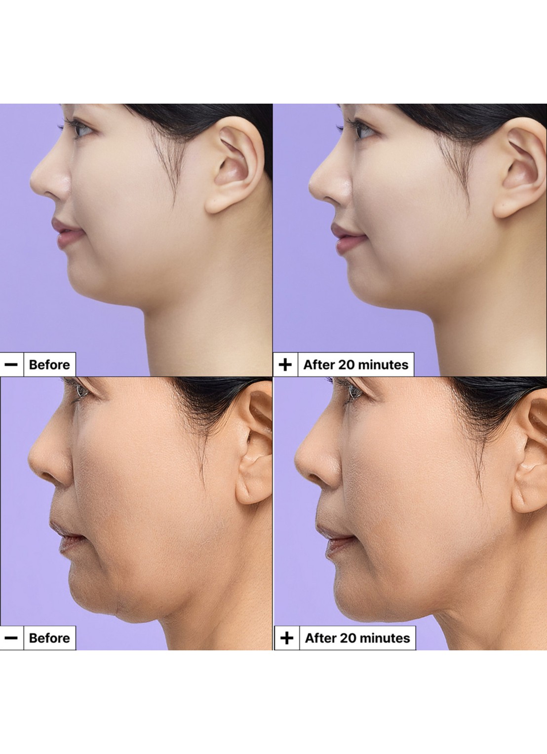 Dr. Jart+ Cryo-V Sculpt Jawline Lifting Mask - gezichtsmasker - detail 5 undefined