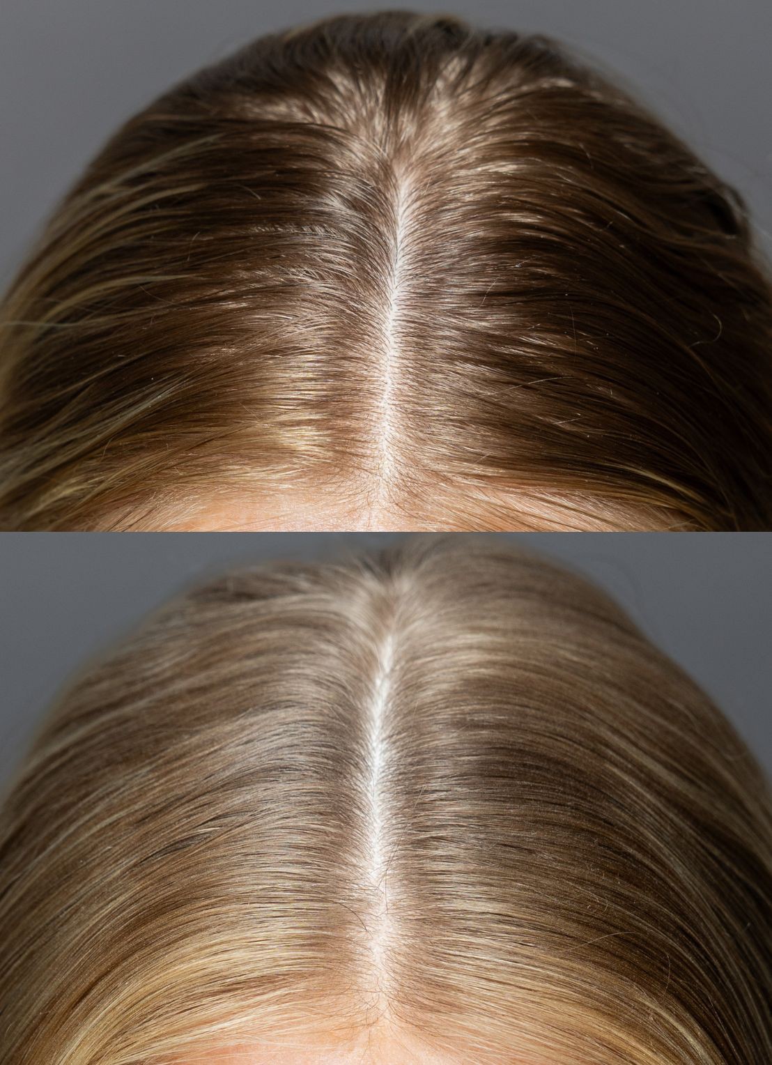 Feather Women Healthy Hair Dry Shampoo - droogshampoo - detail 4 undefined