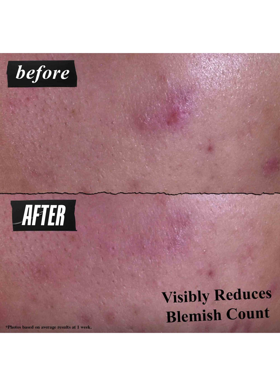 Kiehl's Gently Effective Blemish-Treating Cleansing Paste - gezichtsreiniger - detail 2 undefined