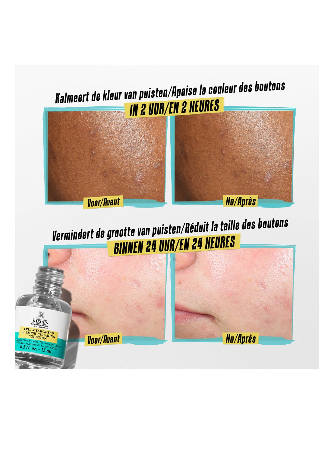 Kiehl's Truly Targeted Blemish-Clearing Solution - gezichtsserum - detail 4 undefined