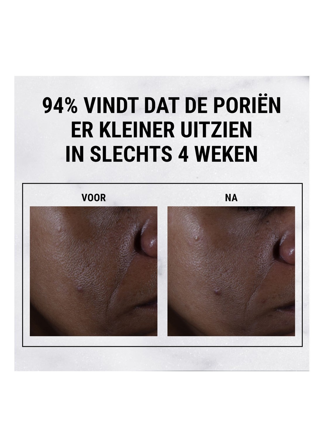 Kiehl's Ultra Pure High-Potency 9,8% Glycolic Acid Serum - detail 6 undefined