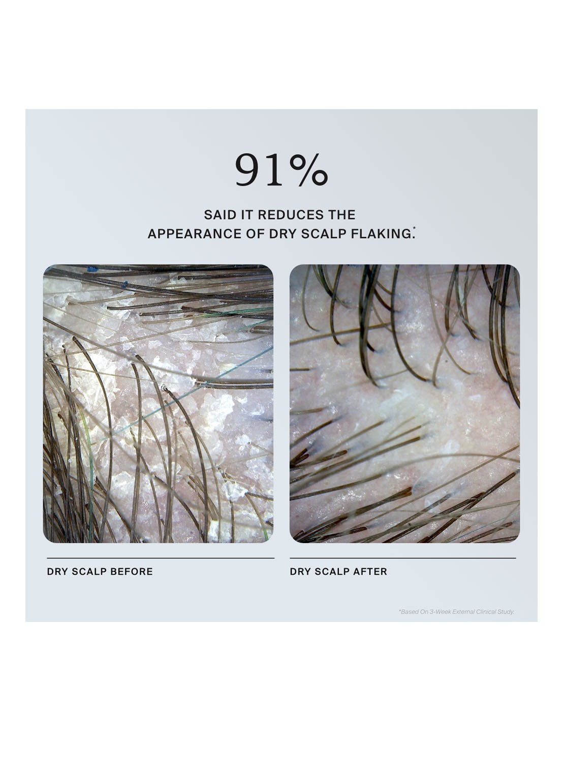 Living Proof Scalp Care Exfoliator - hoofdhuidverzorging - detail 5 undefined