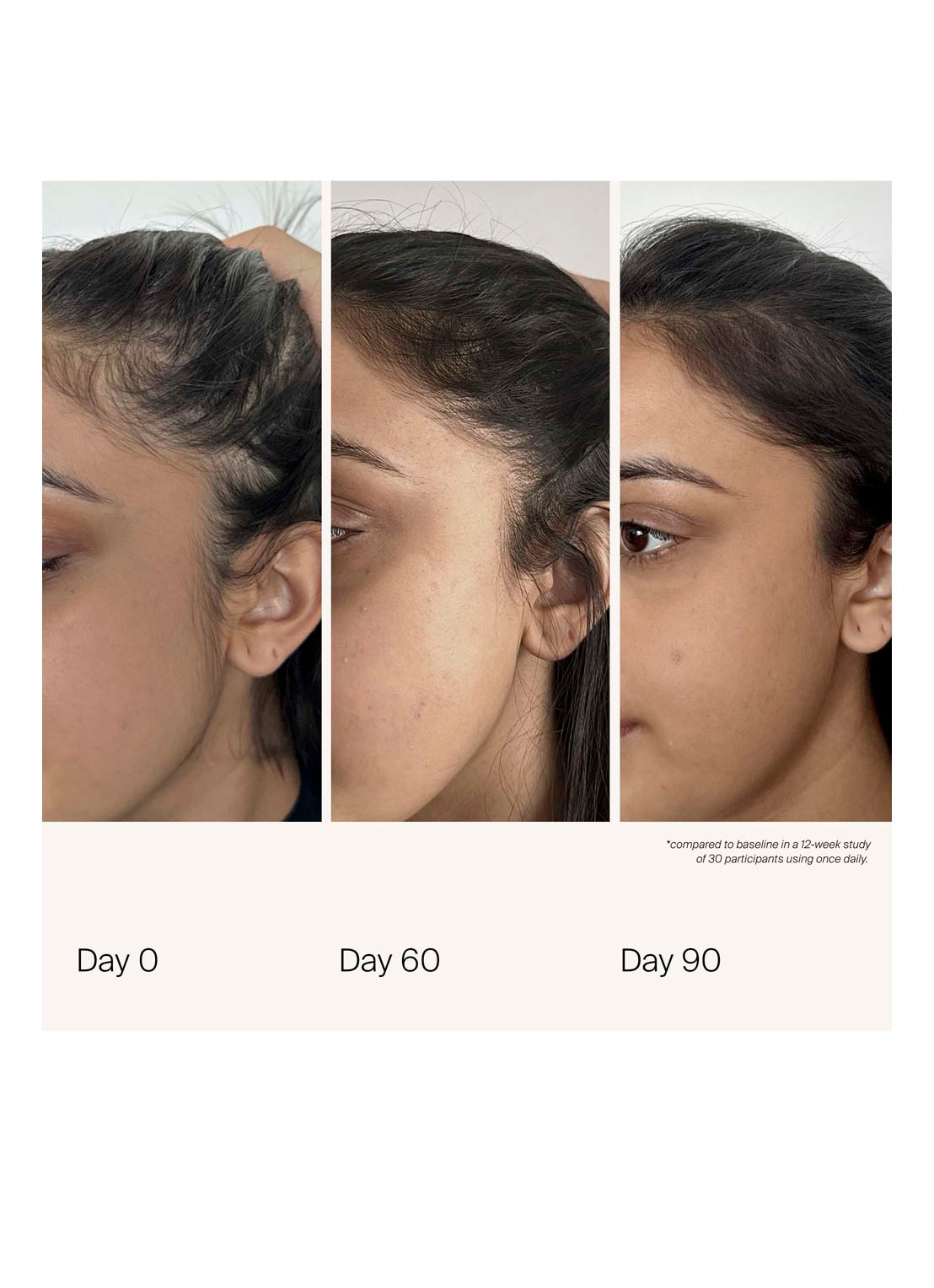 Living Proof Scalp Density Serum - hoofdhuid serum - detail 2 undefined