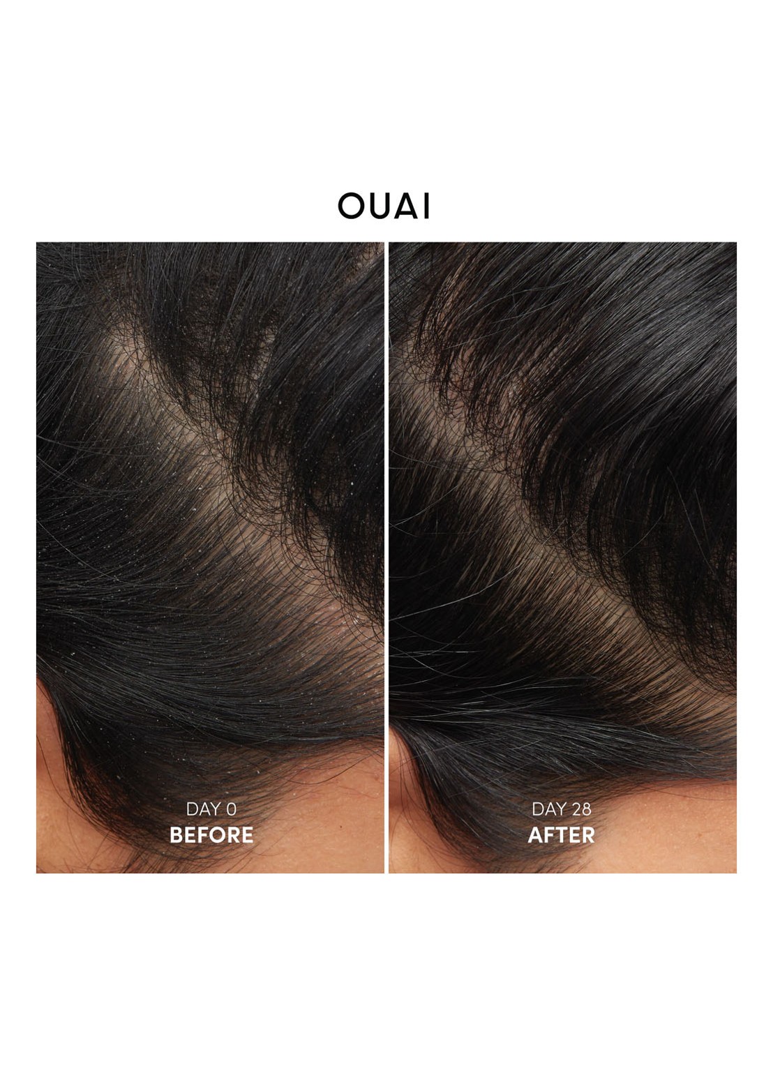 OUAI Anti-Dandruff Shampoo  - anti-roos shampoo - detail 2 undefined