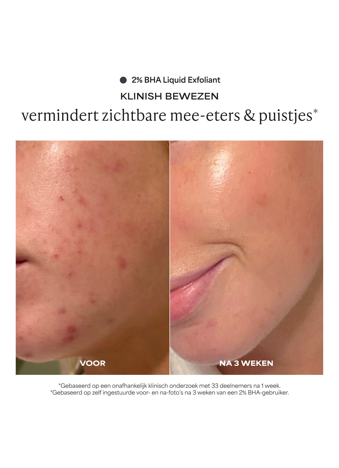 Paula's Choice Facial Exfoliating Duo - verzorgingsset - detail undefined