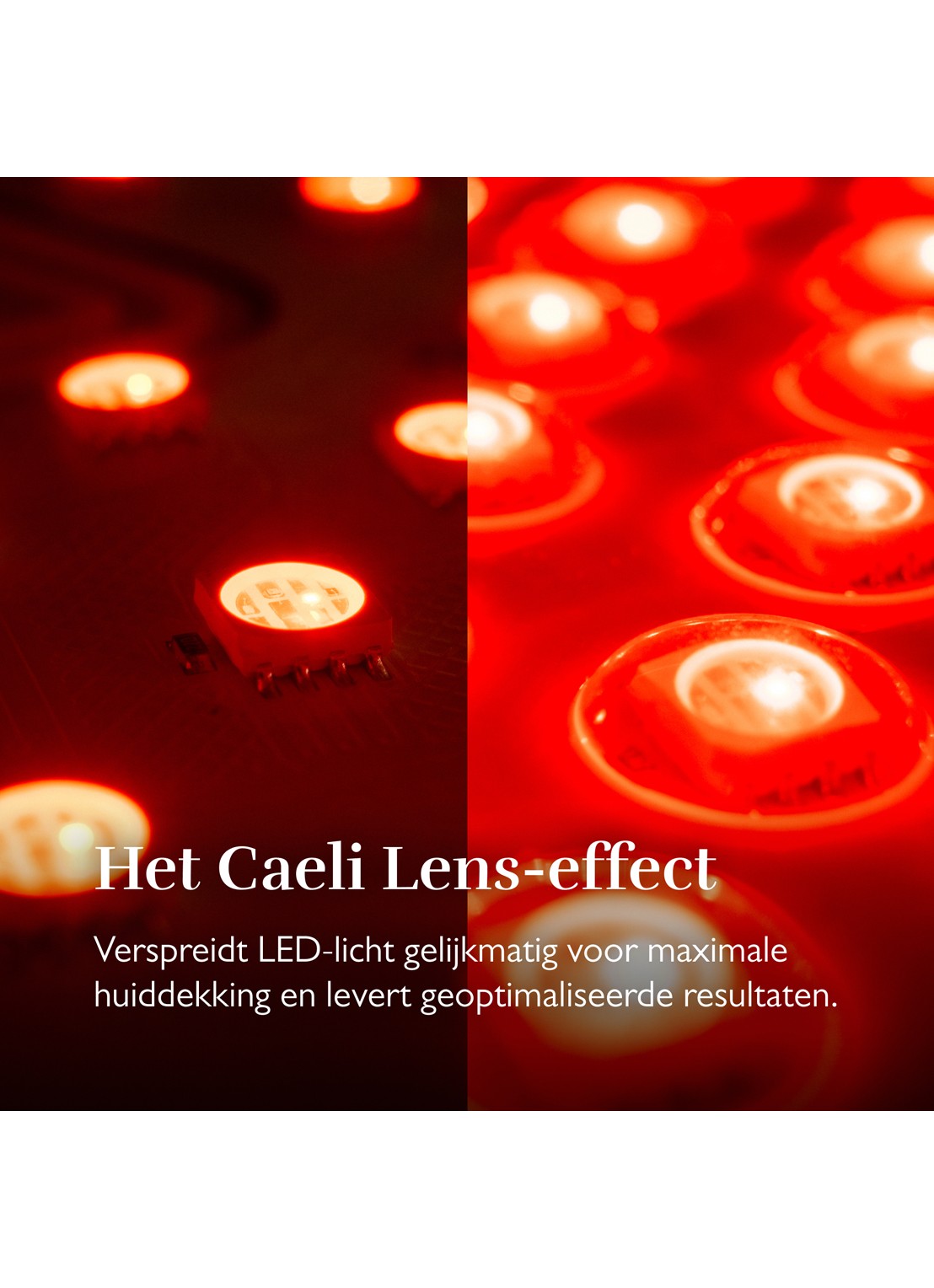 Silk'n LED Face Mask PRO - lichttherapie gezichtsmasker - detail 5 undefined
