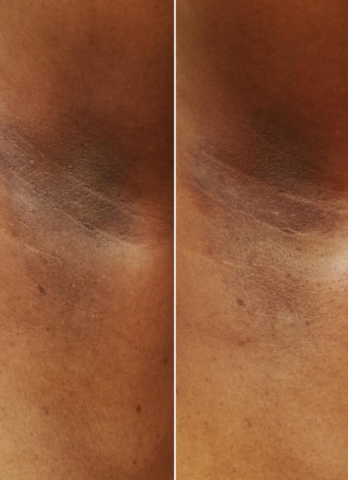 Sol de Janeiro Rio Deo Cheirosa 62 - deodorant - detail 3 undefined