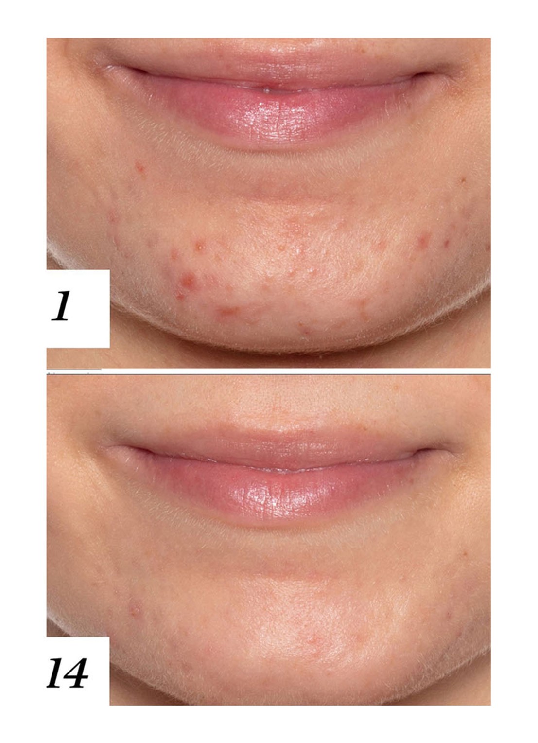 Sunday Riley U.F.O. Ultra Clarifying Treatment Face Oil - gezichtsolie - detail 3 undefined
