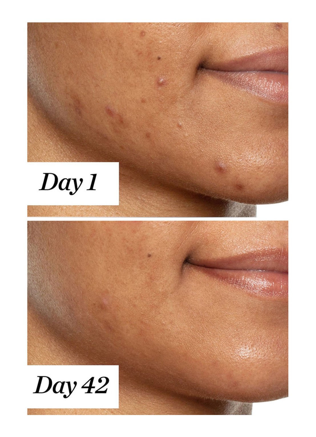 Sunday Riley U.F.O. Ultra Clarifying Treatment Face Oil - gezichtsolie - detail 4 undefined