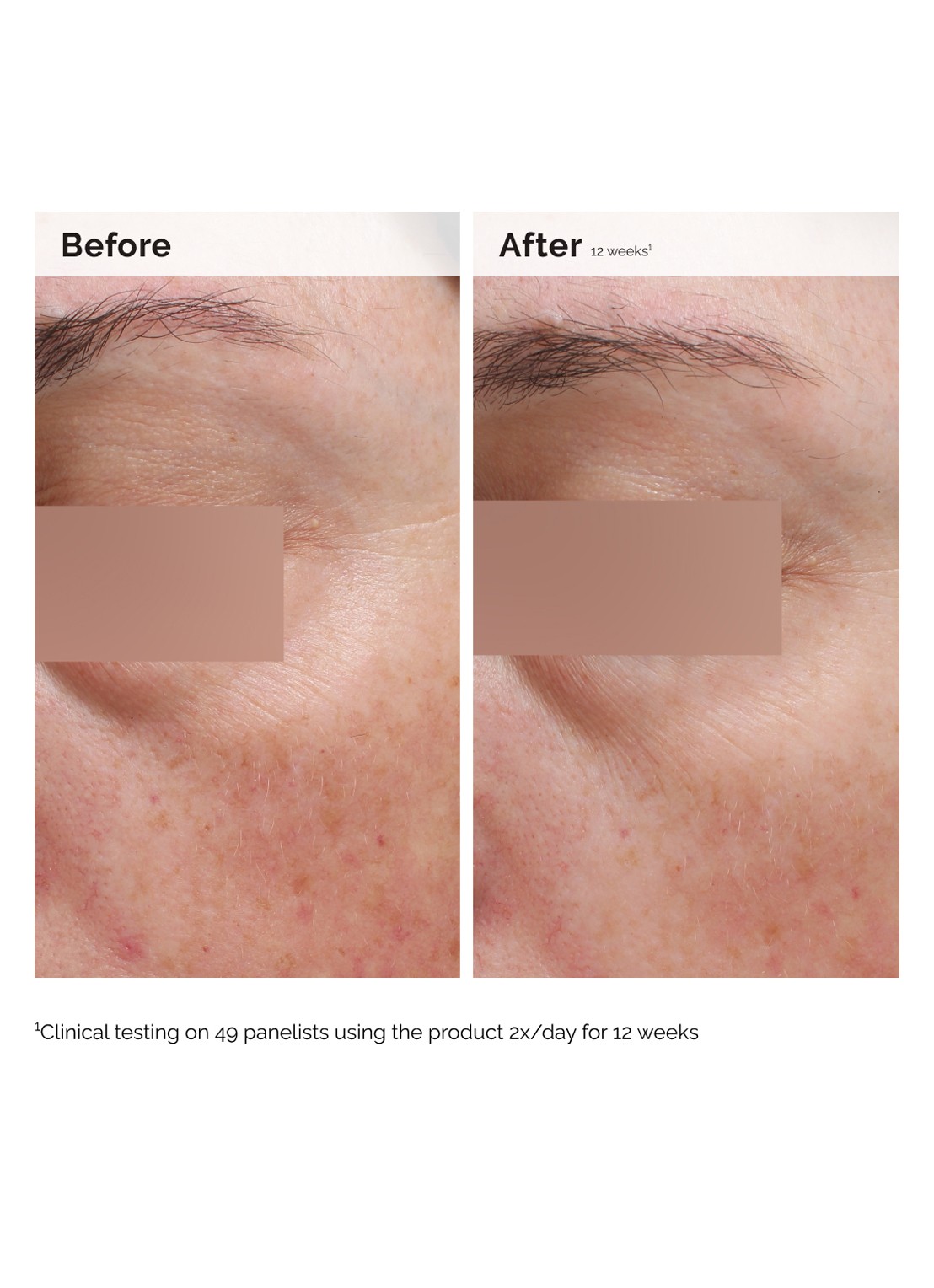 The Ordinary Niacinamide 5% Face & Body Emulsion - gezichts- en lichaamsserum - achterkant 6 undefined