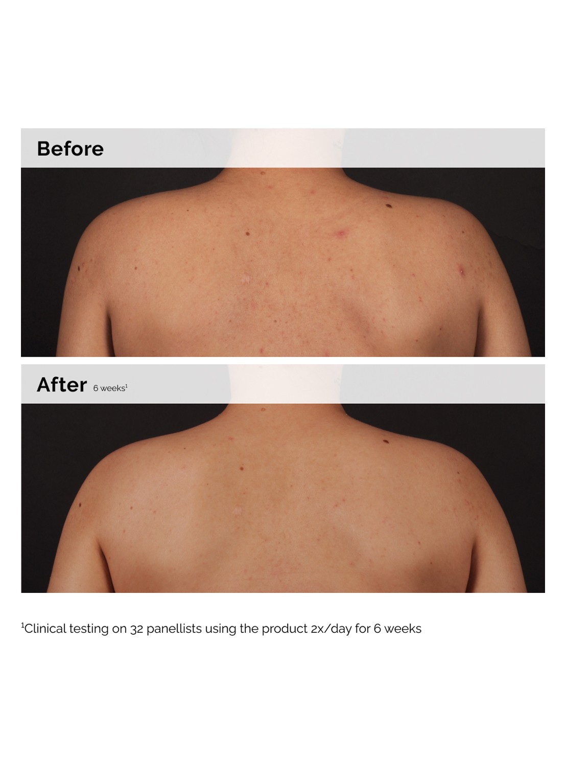 The Ordinary Salicylic Acid 0.5% Body Serum - lichaamsserum - achterkant 8 undefined
