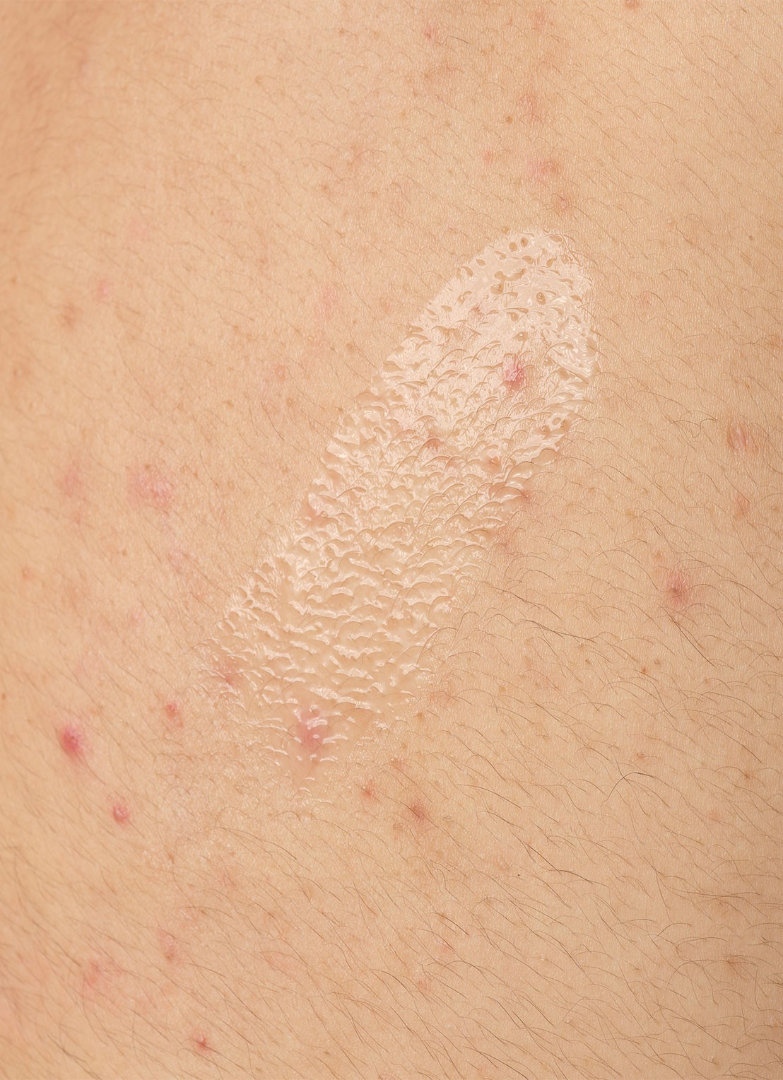 The Ordinary Salicylic Acid 0.5% Body Serum - lichaamsserum - detail 6 undefined