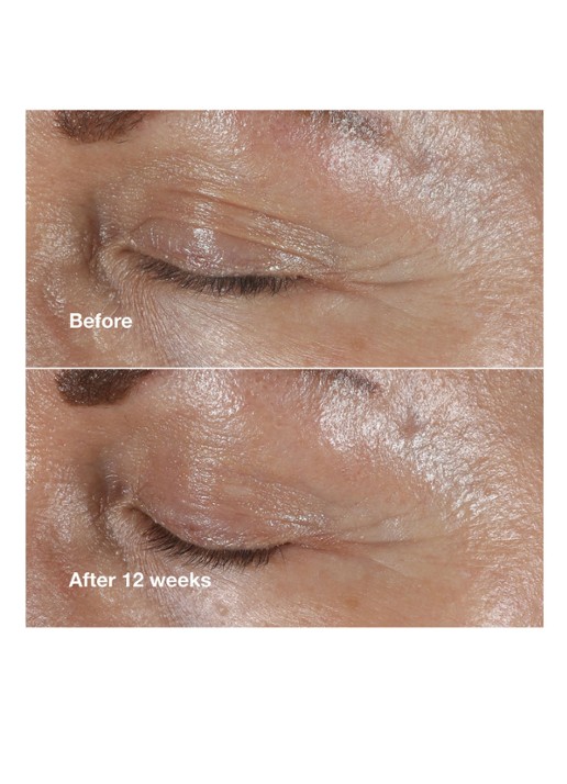 Clinique Clinique Smart Clinical Repair™ Wrinkle Correcting Eye Cream - oogcrème - detail 4 undefined