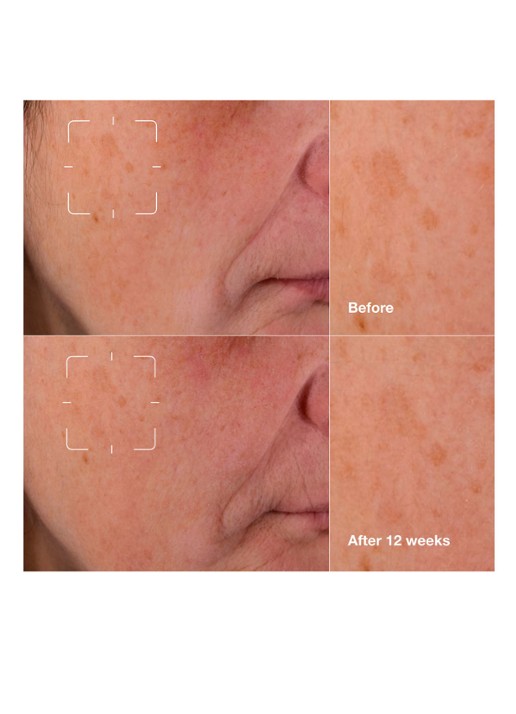 Clinique Even Better Clinical™ Dark Spot Clearing Serum - serum - detail 5 undefined