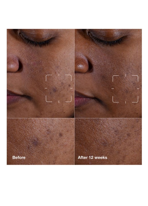 Clinique Even Better Clinical™ Dark Spot Clearing Serum - serum - detail 8 undefined