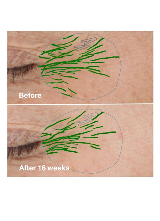 Clinique Smart Clinical Repair™ Wrinkle Correcting Rich Cream - dag- & nachtcrème - detail 3 undefined