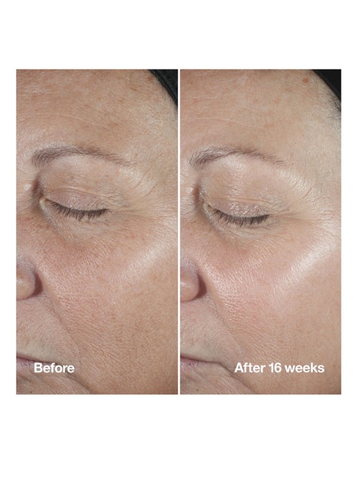 Clinique Smart Clinical Repair™ Wrinkle Correcting Serum - detail 2 undefined