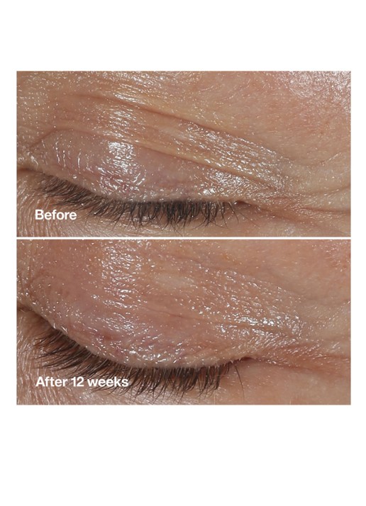 Clinique Smart Clinical Repair™ Wrinkle Correcting Eye Cream - oogcrème - detail 2 undefined