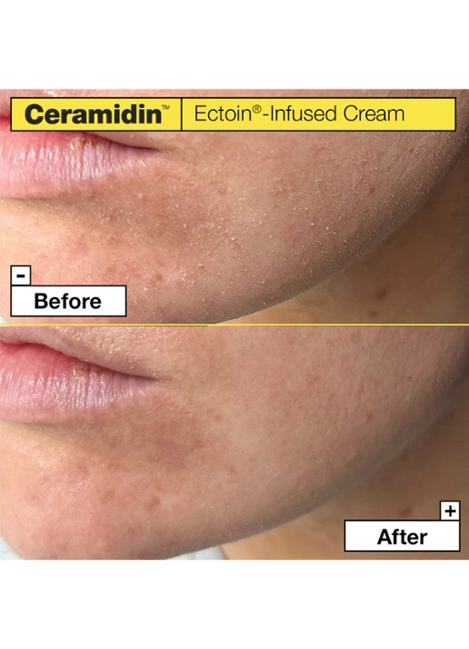 Dr. Jart+ CERAMIDIN™ Ectoin-Infused Cream 50ml Verzorging - Deal