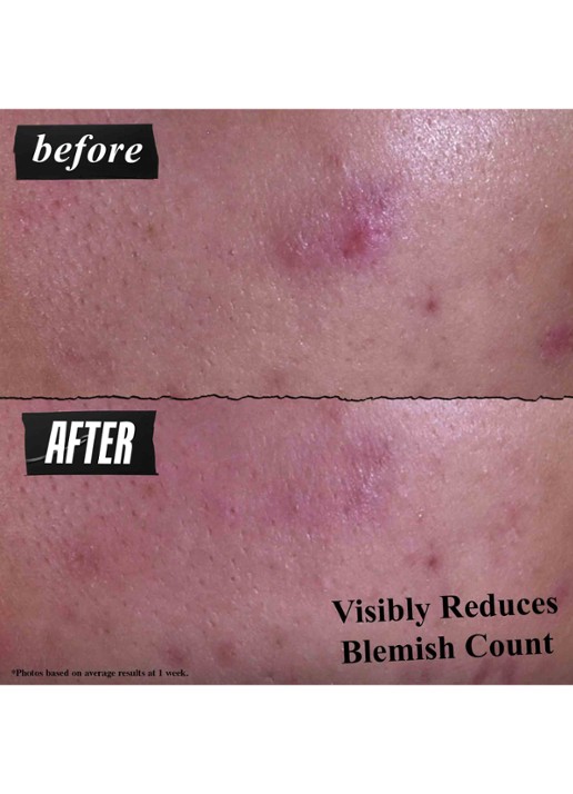 Kiehl's Gently Effective Blemish-Treating Cleansing Paste - gezichtsreiniger - detail 2 undefined