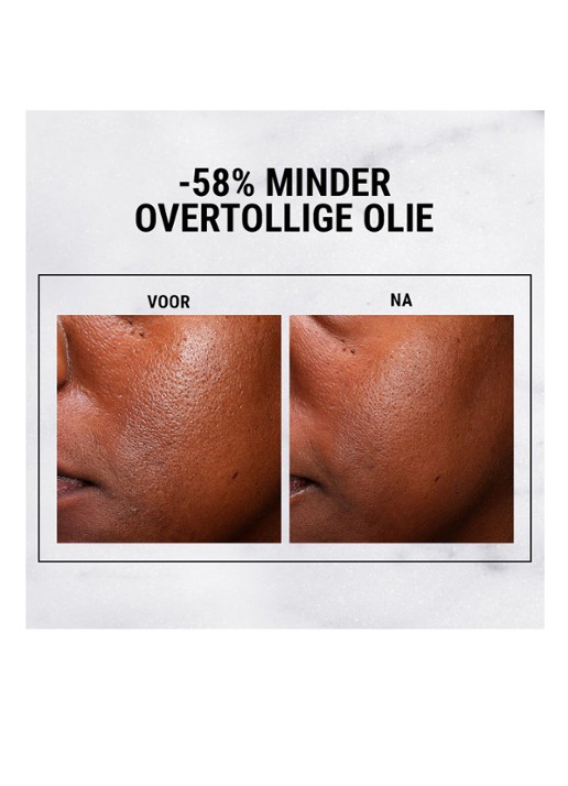Kiehl's Ultra Pure High-Potency 5% Niaciamide Serum - detail 5 undefined