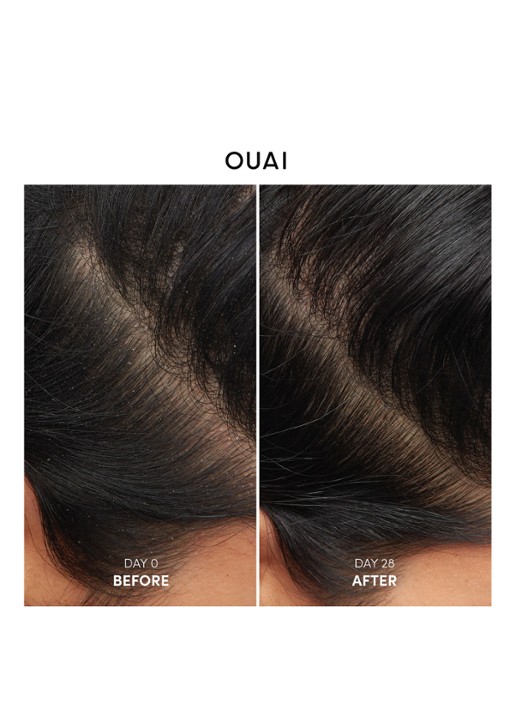 OUAI Anti-Dandruff Shampoo  - anti-roos shampoo - detail 2 undefined