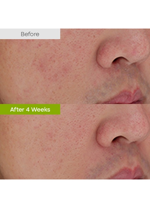 Purito Clear Code Superfruit Cleanser - reinigingsschuim - detail 4 undefined