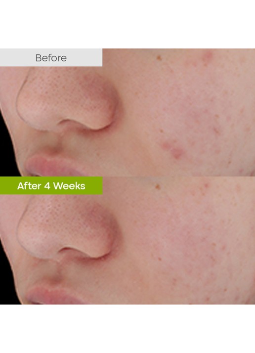 Purito Clear Code Superfruit Serum - detail 4 undefined