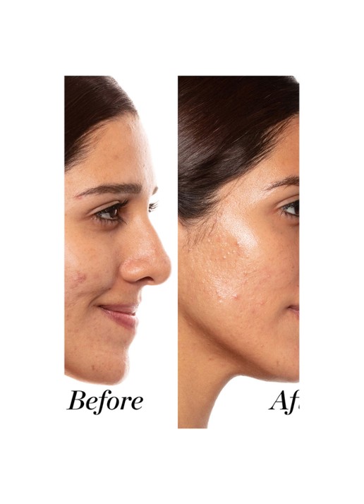 Sunday Riley A+ High-Dose Retinoid Serum - detail 4 undefined