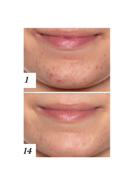 Sunday Riley U.F.O. Ultra Clarifying Treatment Face Oil - gezichtsolie - detail 3 undefined