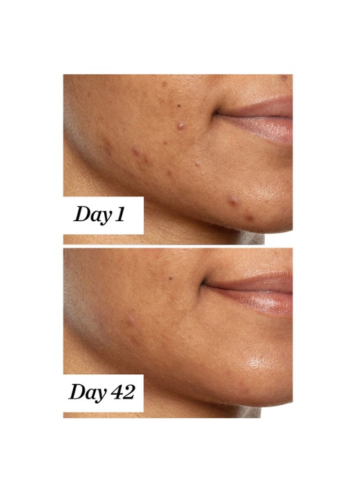 Sunday Riley U.F.O. Ultra Clarifying Treatment Face Oil - gezichtsolie - detail 4 undefined
