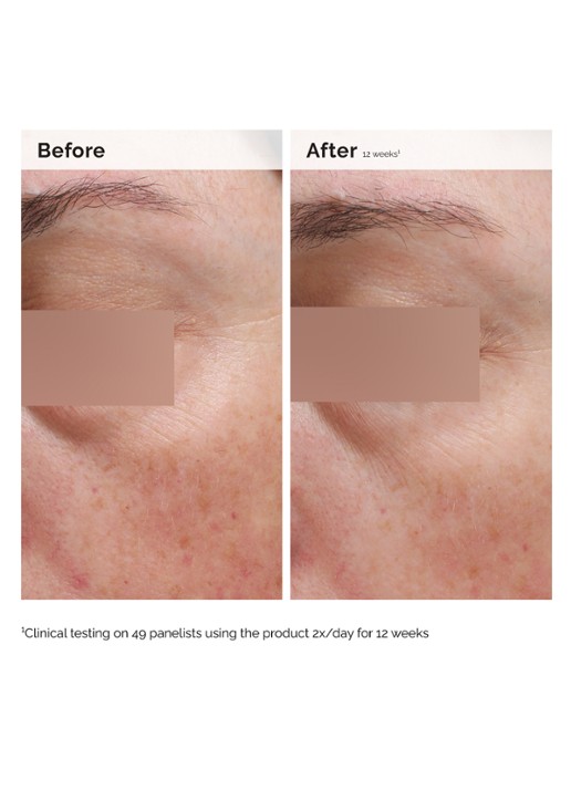 The Ordinary Niacinamide 5% Face & Body Emulsion - gezichts- en lichaamsserum - achterkant 6 undefined