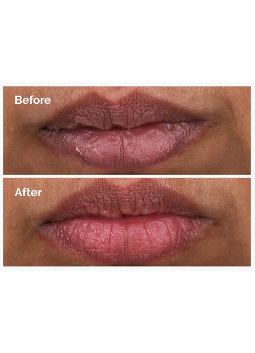 The Ordinary PHA 5% Exfoliating Lip Serum - Lipserum - detail 3 undefined